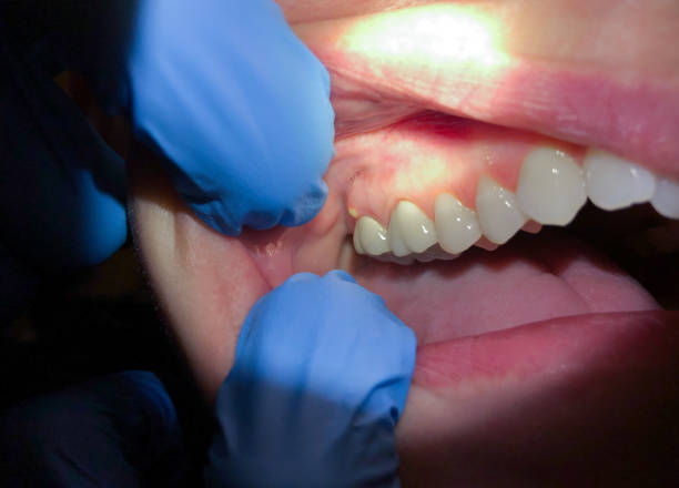 Best After-Hours Emergency Dentist in Brogden, NC